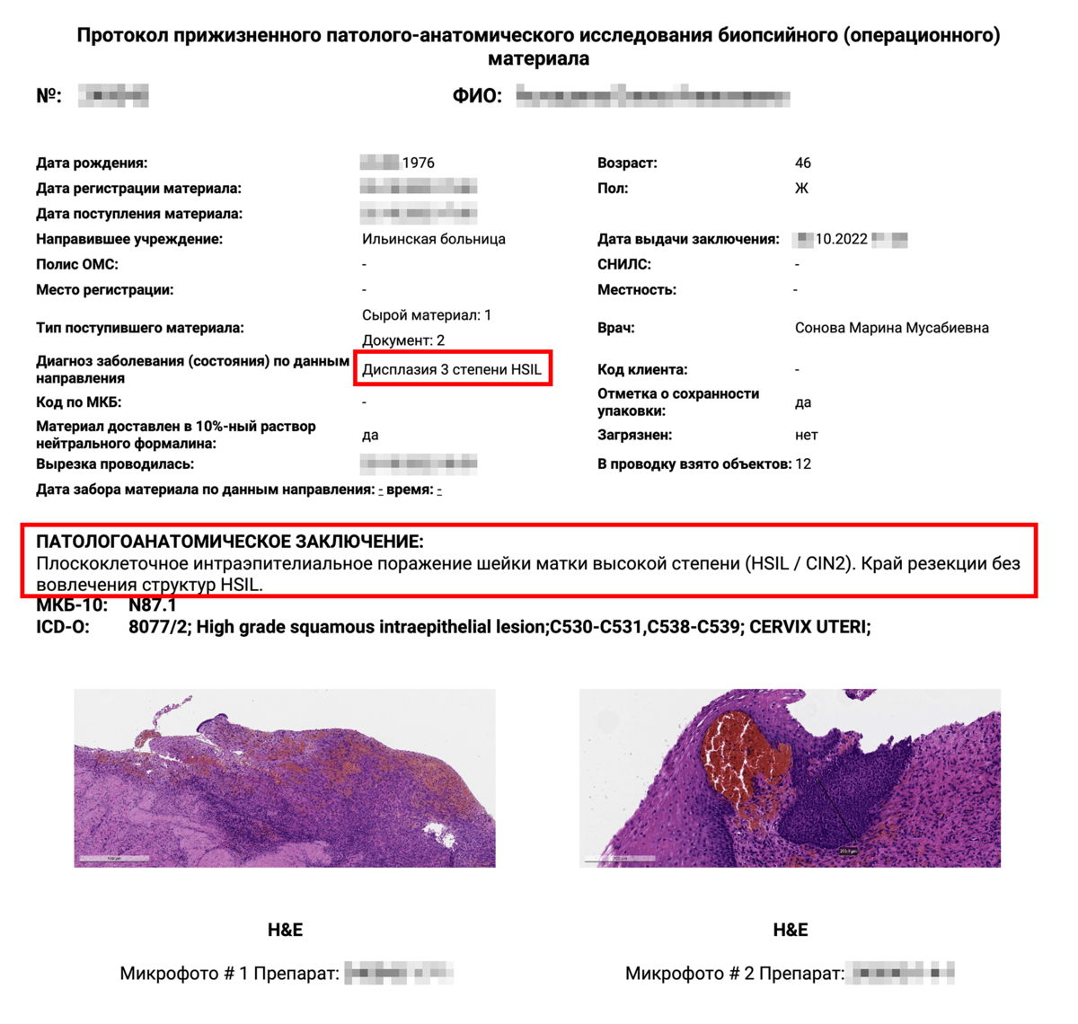 Код мкб шейка матки. Дисплазия шейки матки код мкб. Пример адекватной гистологии.