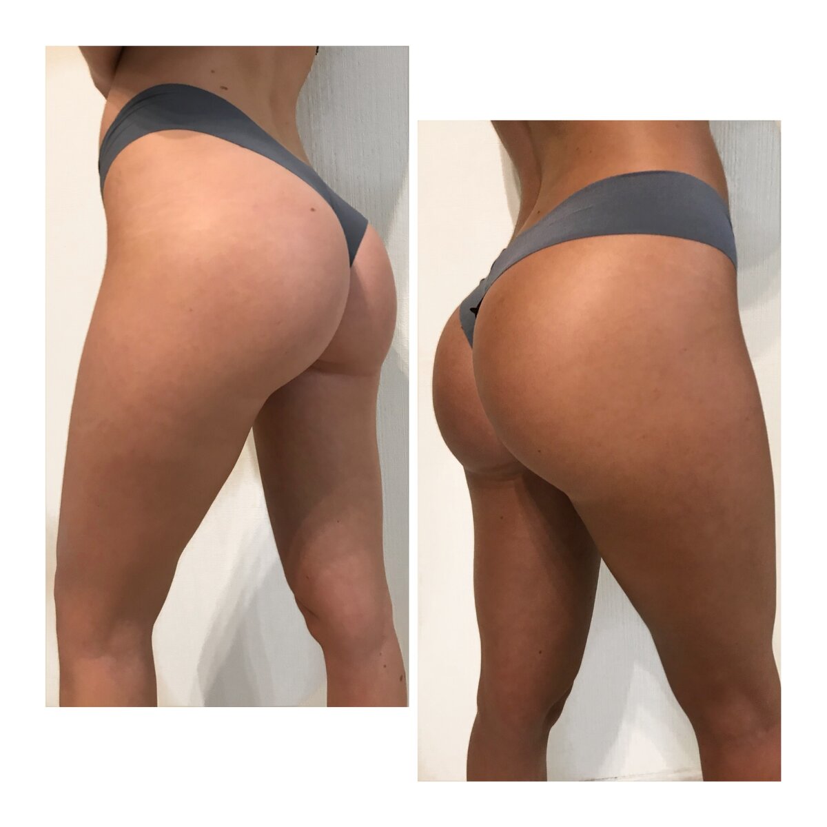 Заменяет 10 сеансов в солярии