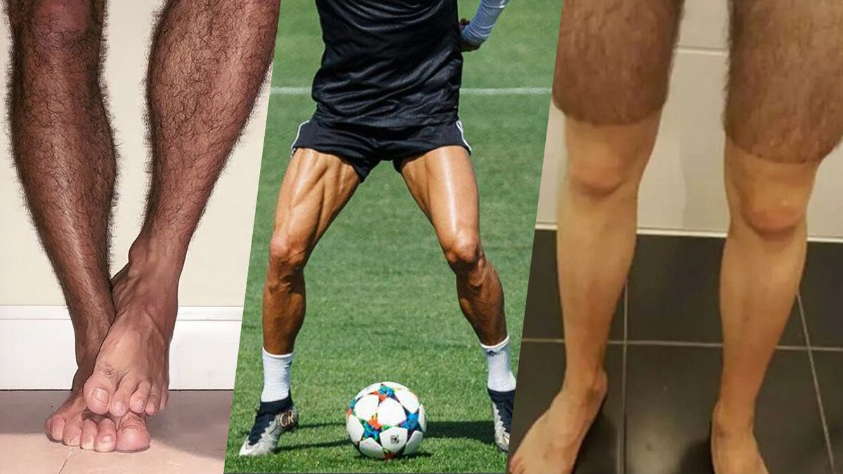 Как избавляются от волос на ногах футболисты