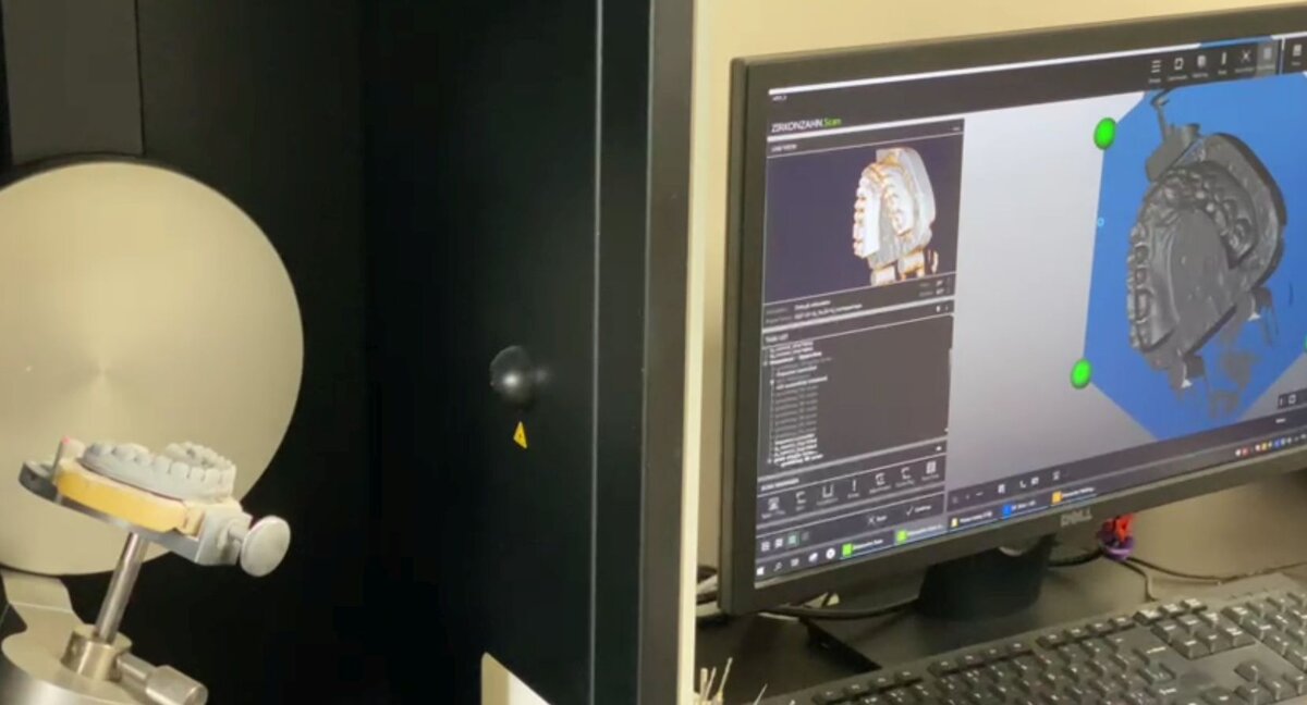 сканирование объекта на 3D сканере