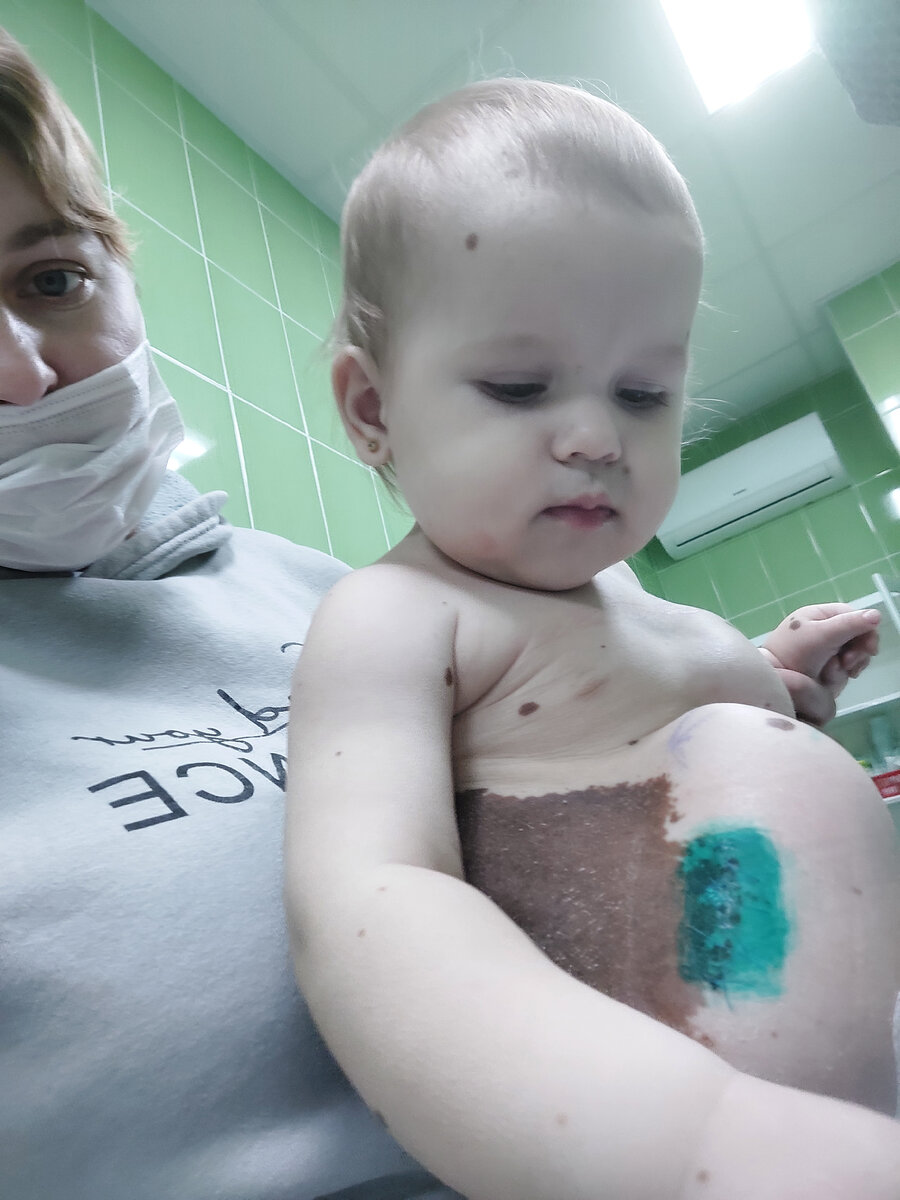 Шарик с левой стороны