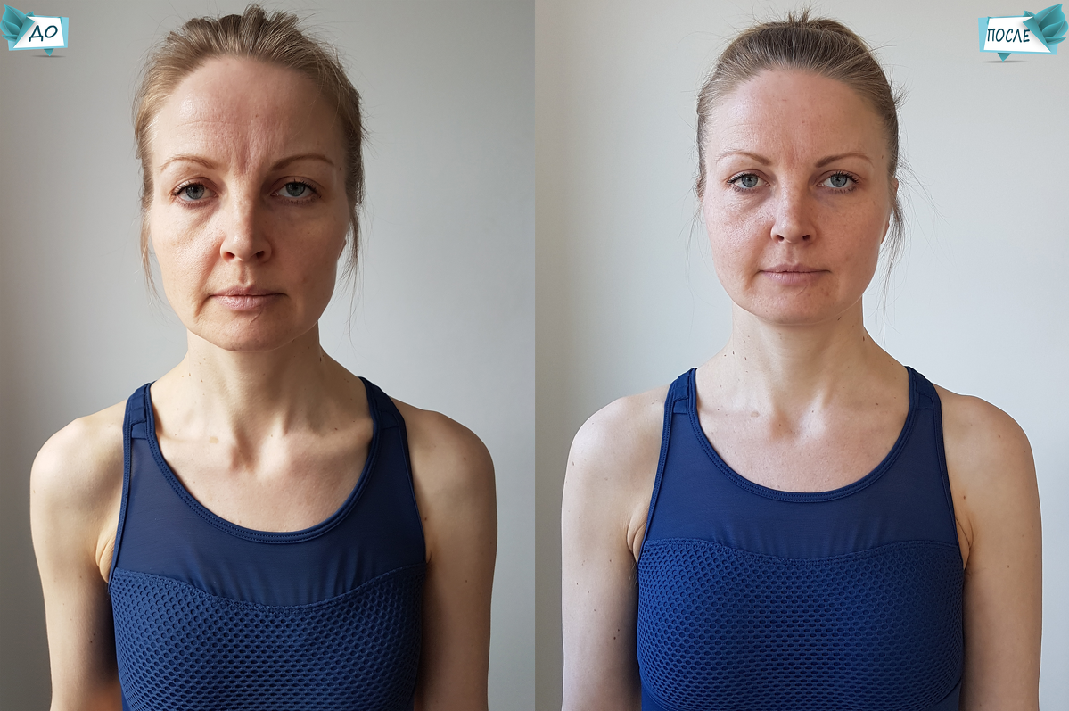 Результат занятий по методики омоложения и оздоровления Натальи Соколовой