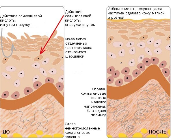 Памятка после проведения пилинга: информация о подготовке и реабилитации после пилинга