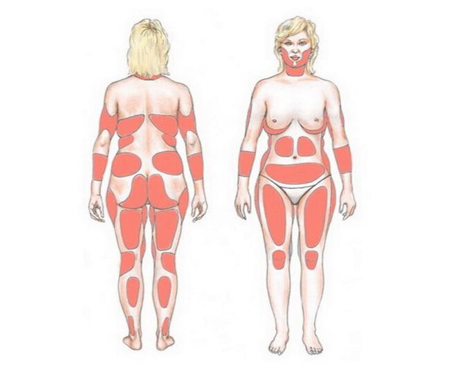 Фото взято из поисковой системы Яндекс