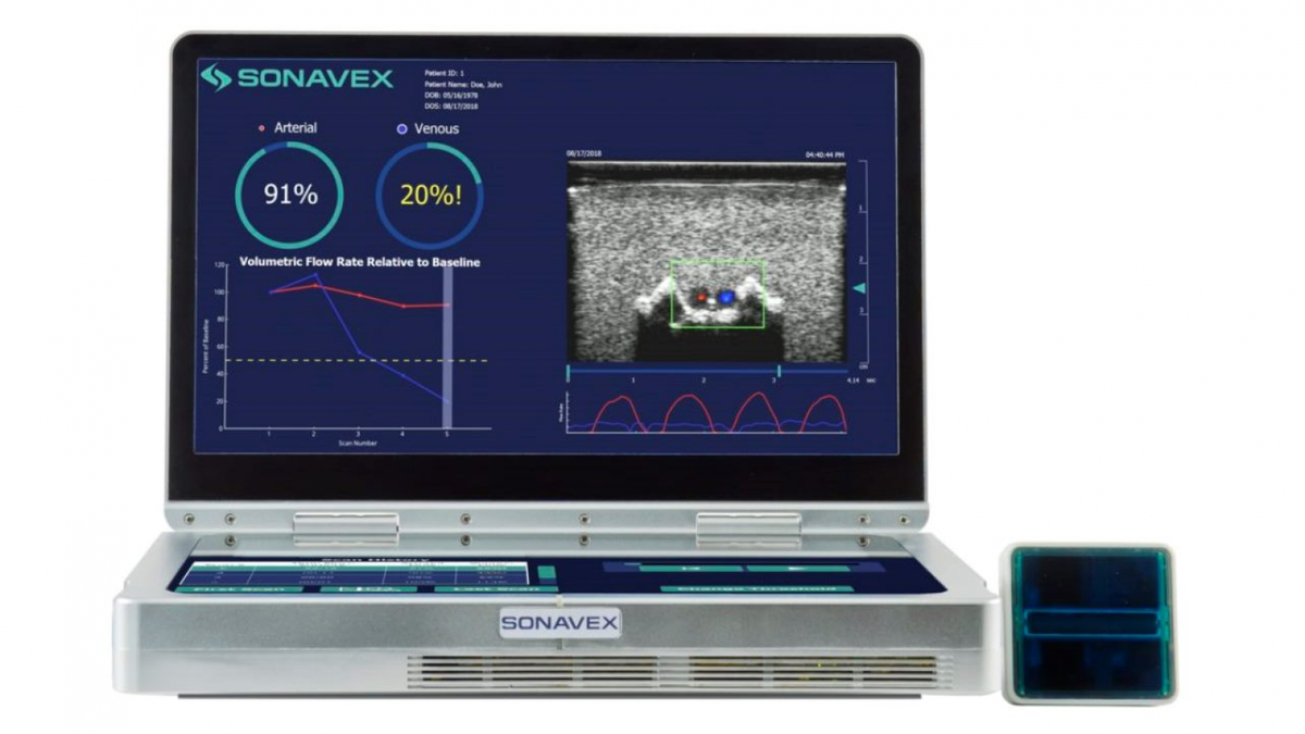 Sonavex EchoSure: ультразвуковой монитор кровотока 