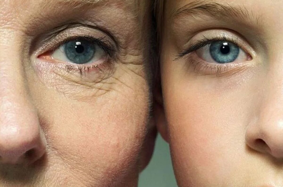 Старение кожи вокруг глаз