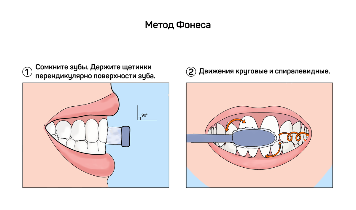 Круговой метод чистки зубов fones. Методы чистки зубов Фонеса. Стандартный метод чистки зубов методика.