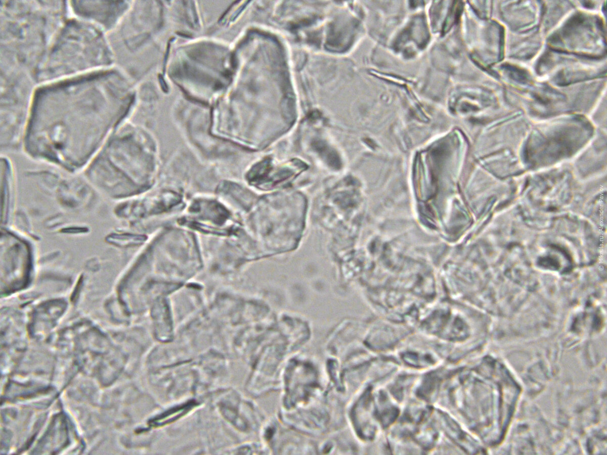 Мед под микроскопом картинки