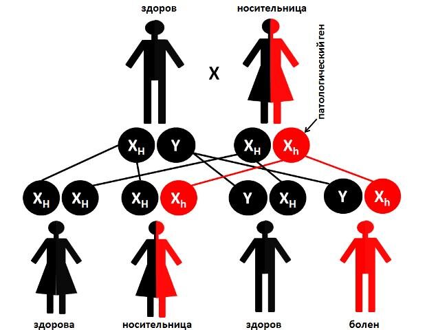 Отец девушки страдает гемофилией. Схема наследования гемофилии. Схема передачи гемофилии по наследству. Гемофилия передается по наследству. Гемофилия Тип наследования.