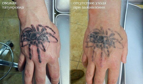 Тут вы можете увидеть последствия если не ухаживать за татуировкой