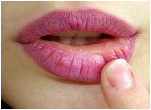 Фотография взята из источника chernogolovka.net