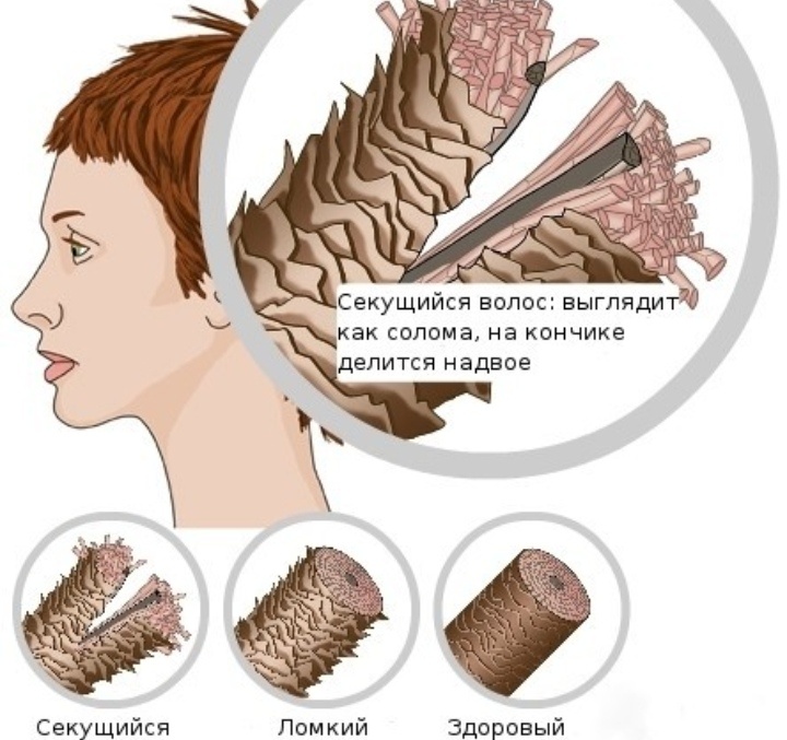 Картинка взята из свободных источников сети интернет 