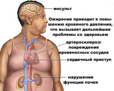 Ожирение – это про принятие или же всё-таки избавление?