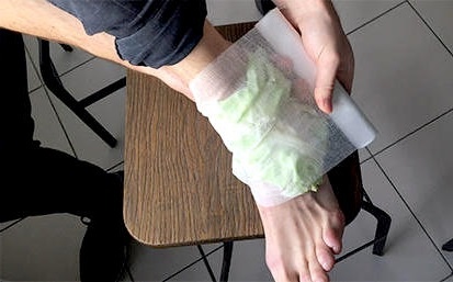 Капустный компресс