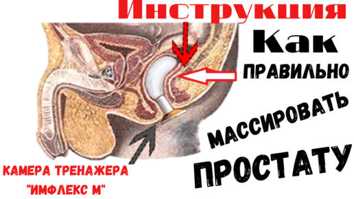 Массаж предстательной железы (простаты): описание, симптомы, диагностика и лечение | ЛабСтори