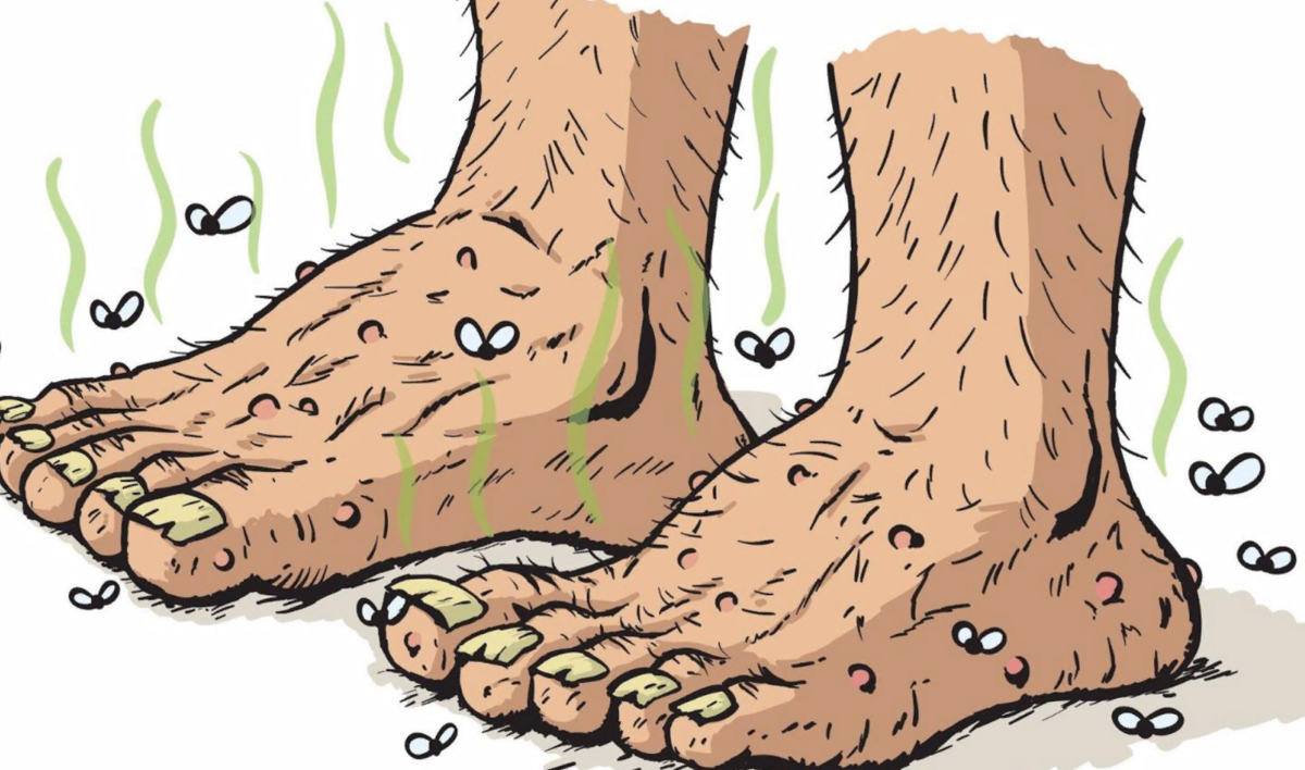 Причины возникновения и методы устранения неприятного запаха ног
