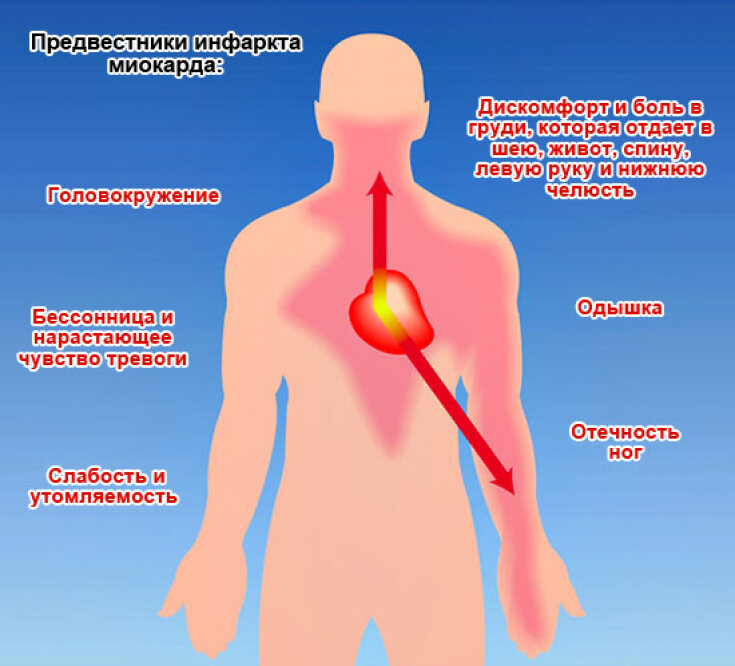 Как болит сердце. Предвестники сердечного приступа. Боль в сердце симптомы.