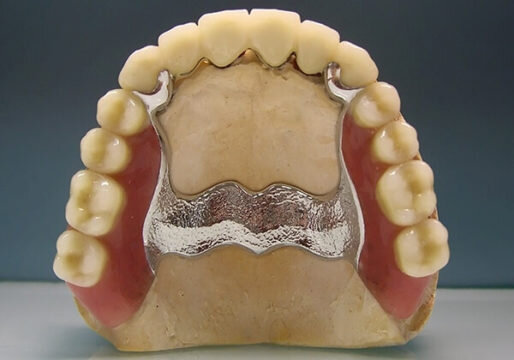 Источник: https://ozubkah.ru 