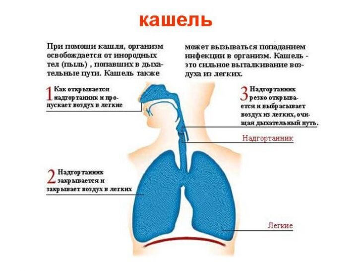 (рус) Гастроэзофагеальный рефлюкс у беременных