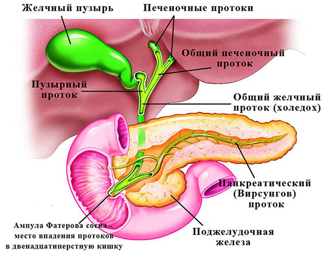 Что такое холедохолитиаз и почему он возникает