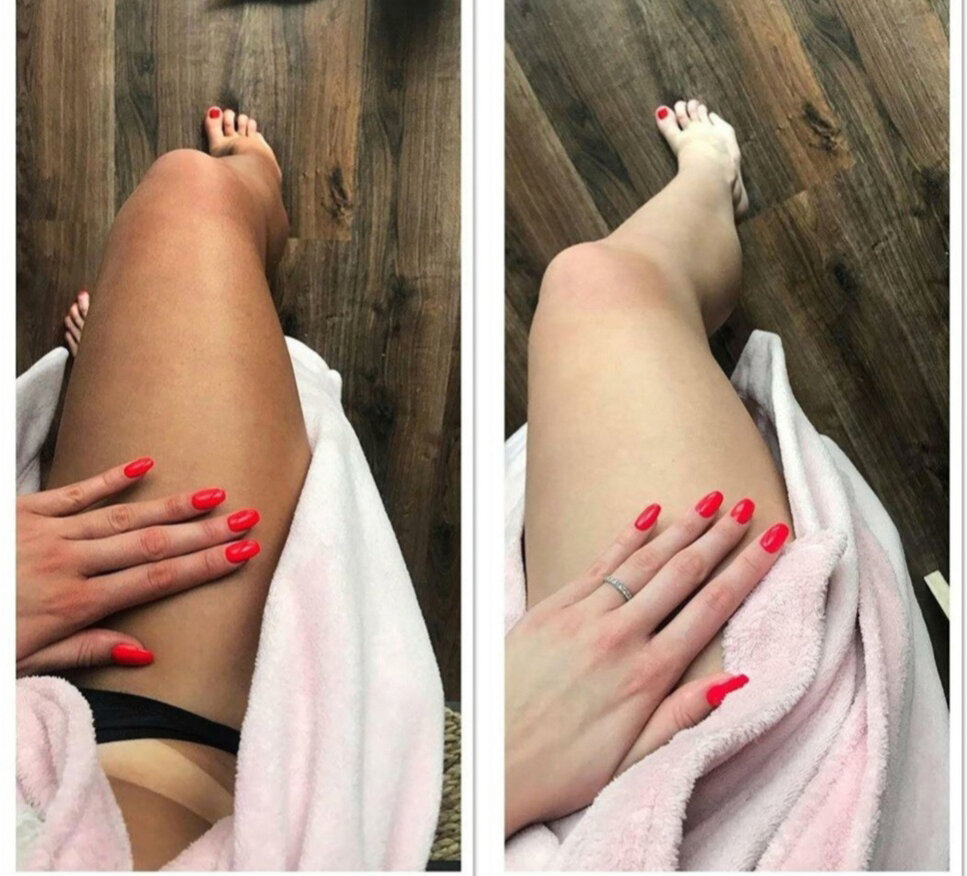 Ровный загар без солнца и солярия: 9 грамотных советов, как правильно ...