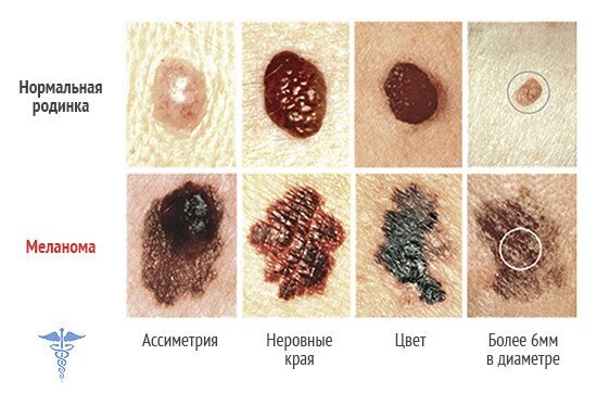 Источник: https://bit.ly/2MnRXfQ