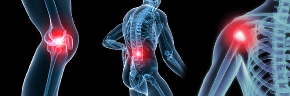 Артроз и артрит - распространенные заболевания современности