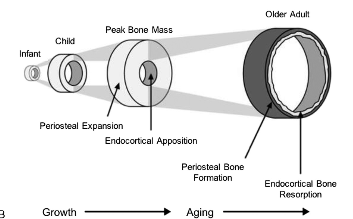 Как выглядят наши кости с возрастом (младенец, ребёнок, взрослый, пожилой) 