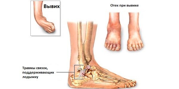 Взято с открытых источников