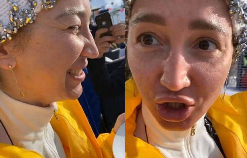 Тут хорошо видна кожа! Для сравнения с предыдущим фото (фото из открытых источников Яндекс.Картинки)