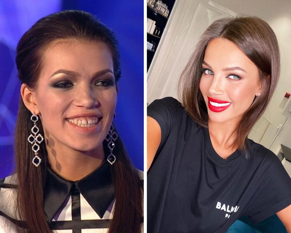 Эскортницы и большие губы! Зачем девушки накачивают части тела и почему это не о