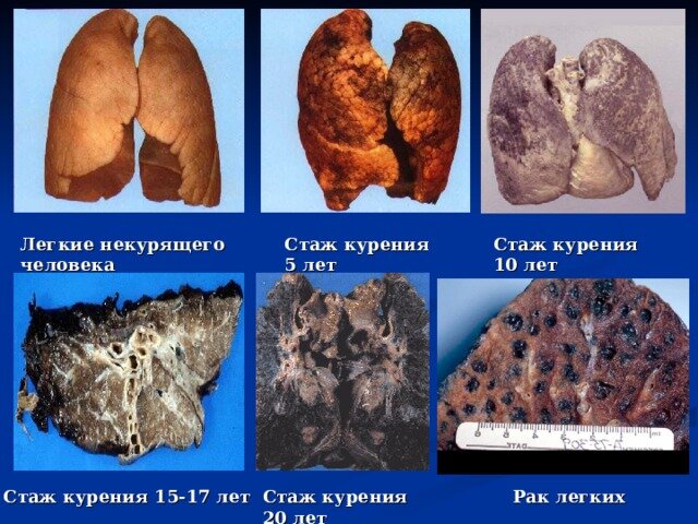 Без комментариев... Выбор за вами...