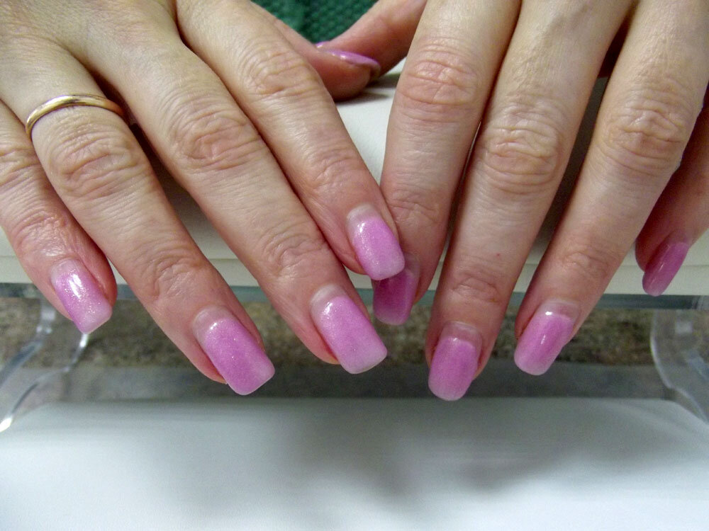 Такими руки были до начала работы. Фото автора.