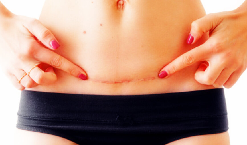 Любая операция носит свои риски