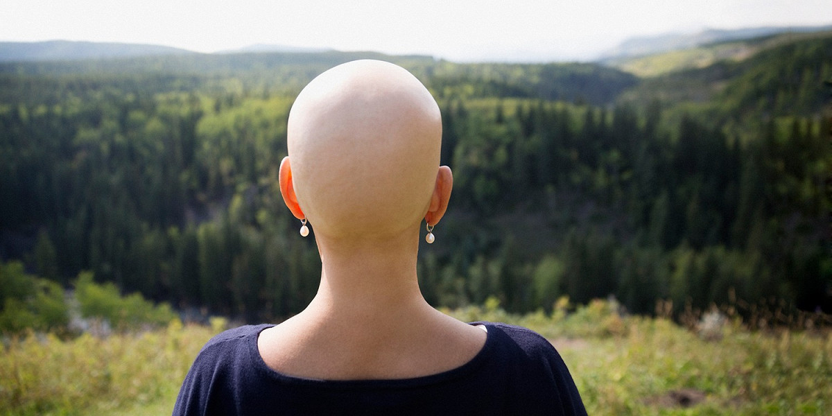 Chemotherapie ohne haarausfall