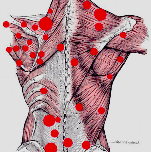 Триггерные точки