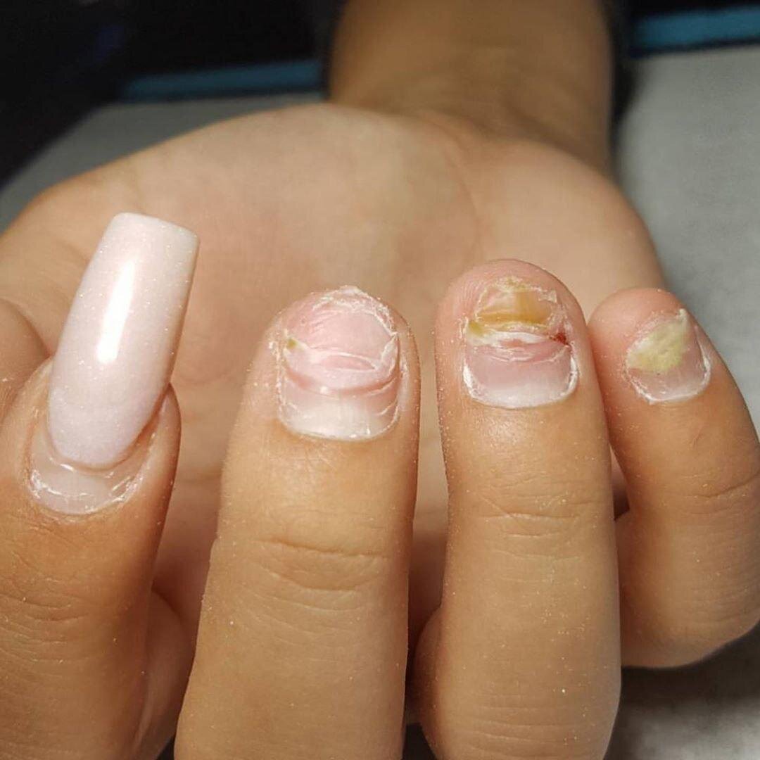 Ваши ногти не восстановятся после того, как вы содрали гель-лак. Развеиваю мифы по восстановлению ногтей