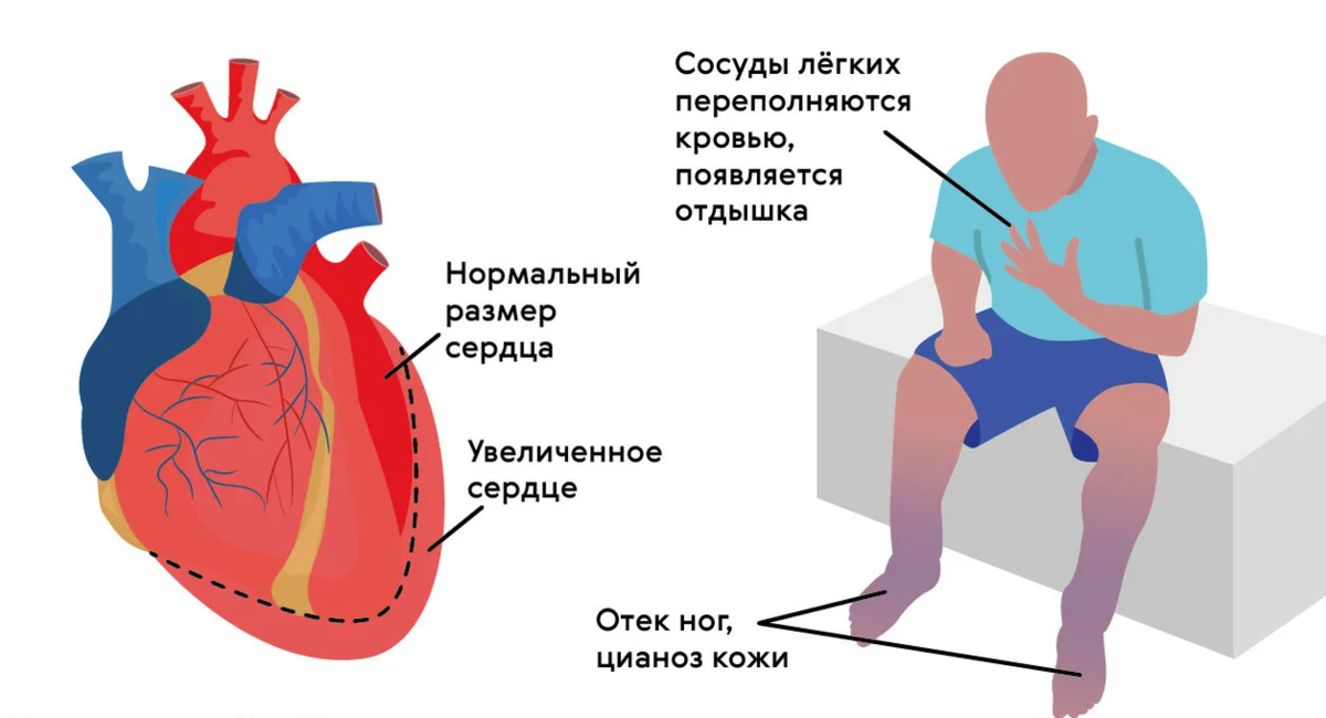 Будет ли опасность в моем сердце 3