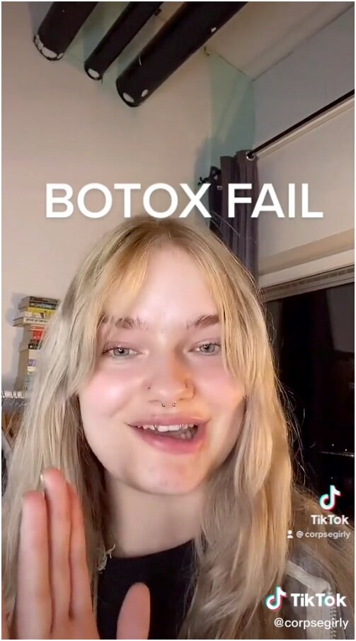    Оказалось, токсин затек в соседнюю мышцуtiktok.com/@corpsegirly