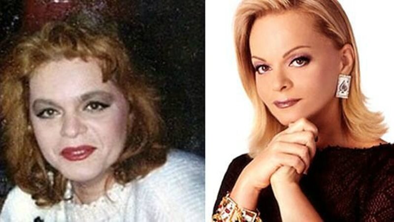 Лариса долина фото до и после