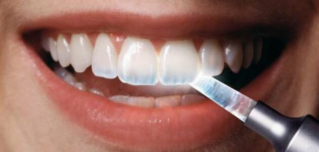Ученые научились выращивать эмаль зубов. Перевожу с китайского на русский