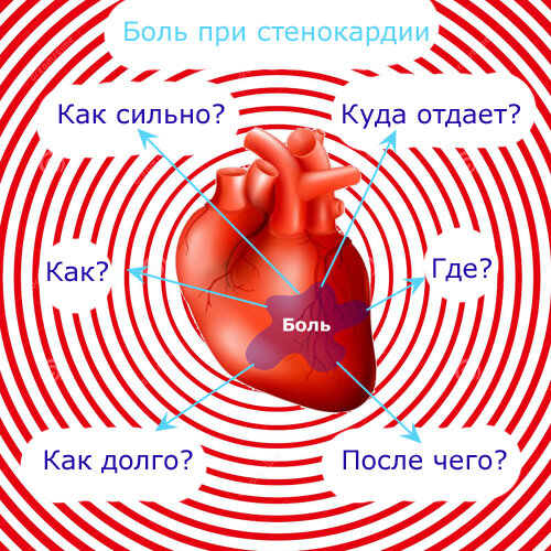 Характеристики боли при стенокардии