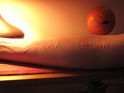 Что такое дермографизм?