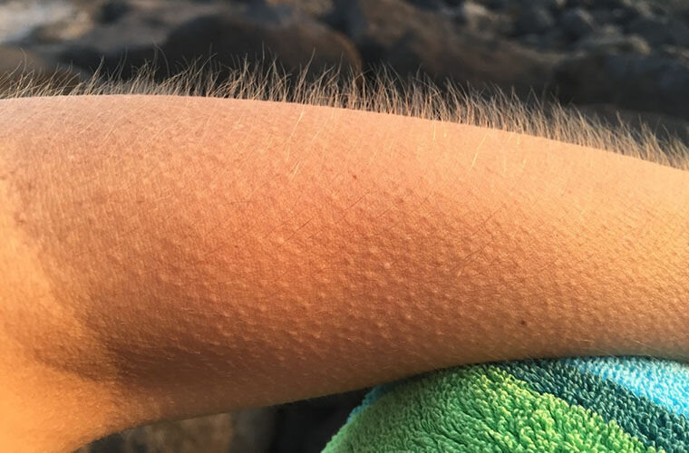 Чтобы поднимать шерсть дыбом: для устрашения врага, для согревания. Реакция на любое раздражение (в том числе позитивное — например, при виде добычи) или испуг, а также способ сообщить окружающим о своем состоянии.