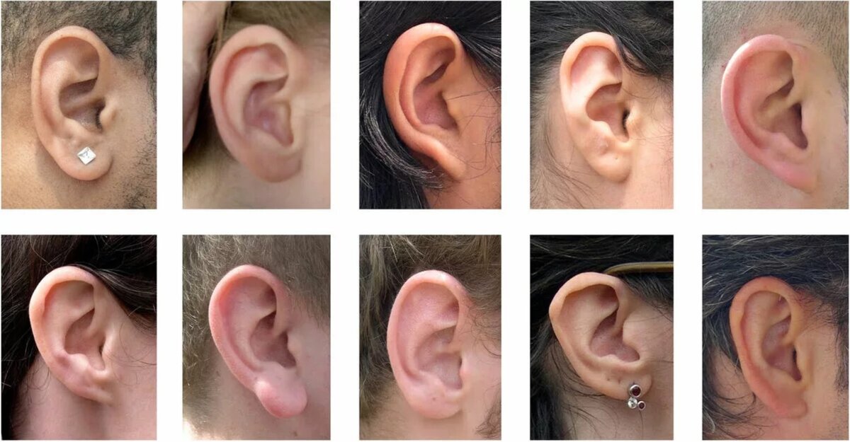 Форма ушей человека подошла для идентификации не хуже отпечатков пальцев или ДНК