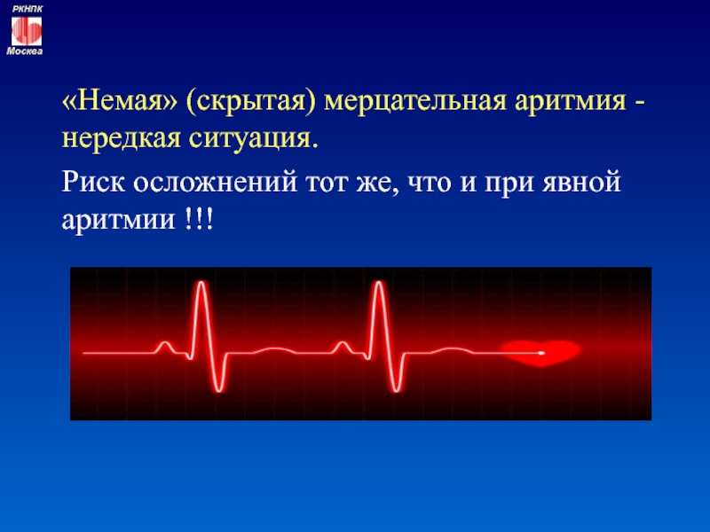 Мерцательная аритмия: без лечения возможны тромбы и проблемы с головным мозгом