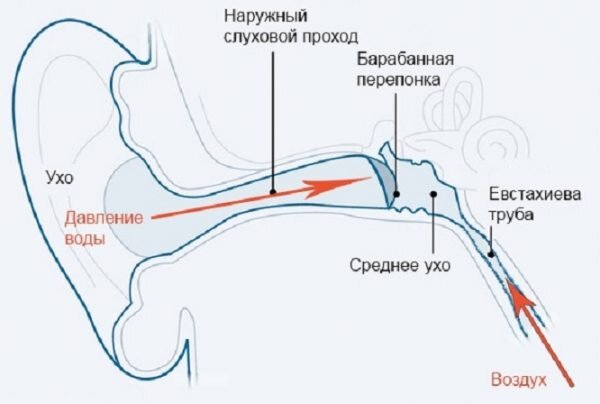 Закладывает уши при взлете