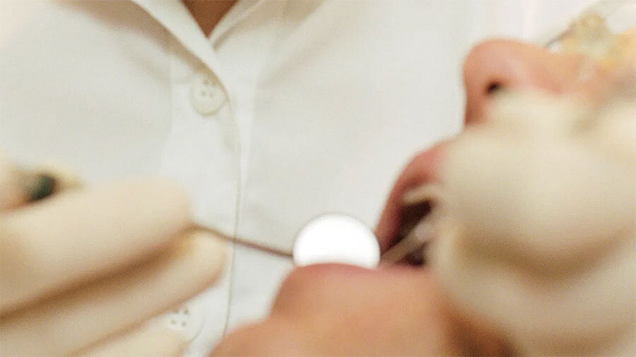 Лечение кариеса