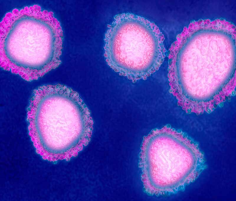 Коронавирус под микроскопом. Фото: Popular Mechanics
