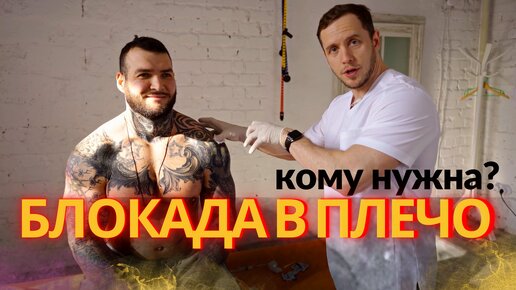 БЛОКАДА в плечо | Сколько стоит | Кому нужна и не нужна?